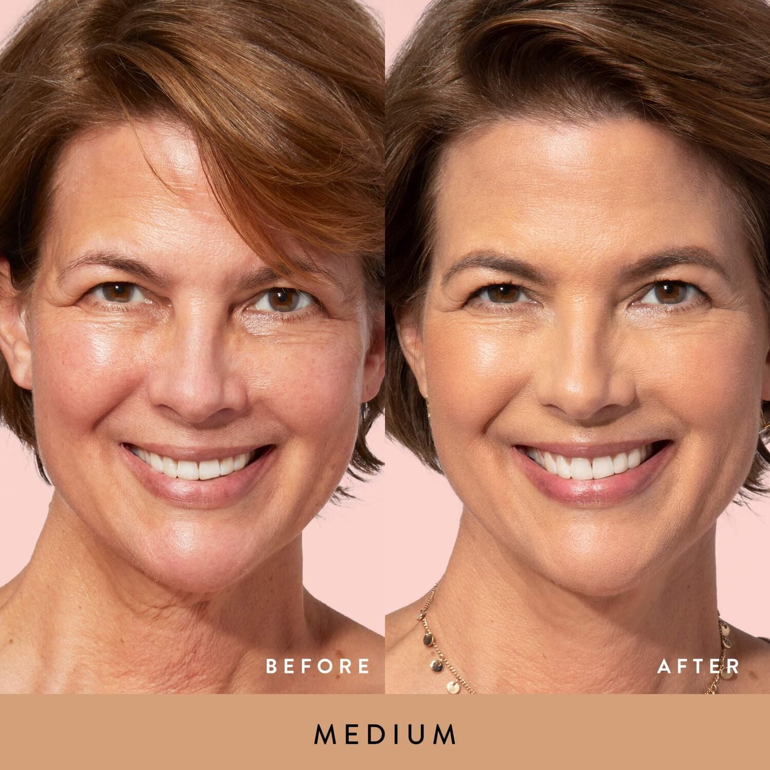BalancenGlow-BeforeAfter_Medium-ECommerce_JPG_1